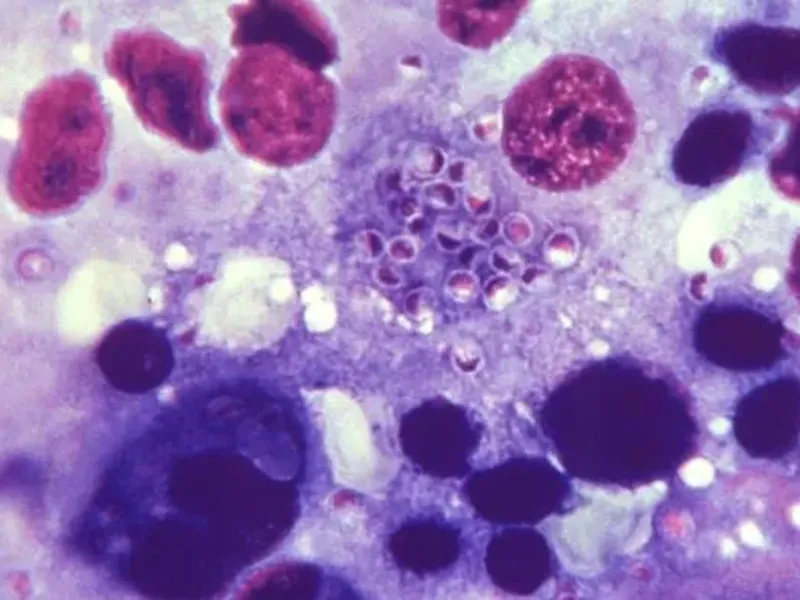 Diagnostic dilemma: Growing weed with bat poop left 2 men with deadly infections: LiveScience